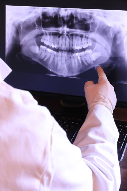 Best Emergency Dental Care for Broken or Chipped Teeth in Aurora, TX