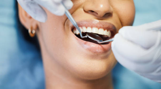 Best Emergency Root Canal Treatment in Aurora, TX